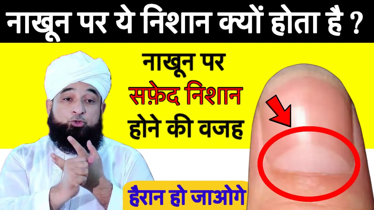 नाखून पर सफेद निशान का मतलब जानकर हैरान हो जाओगे | Nakhun Par Safed Nishan Ka Matlab | GS World