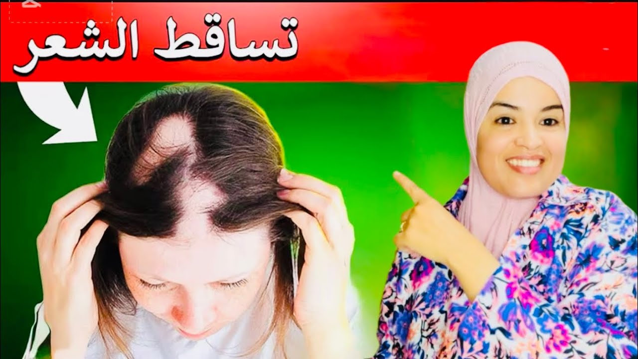 وصفة خطيييرة لتساقط الشعر 😱 طبيعية ومجربة 100% 