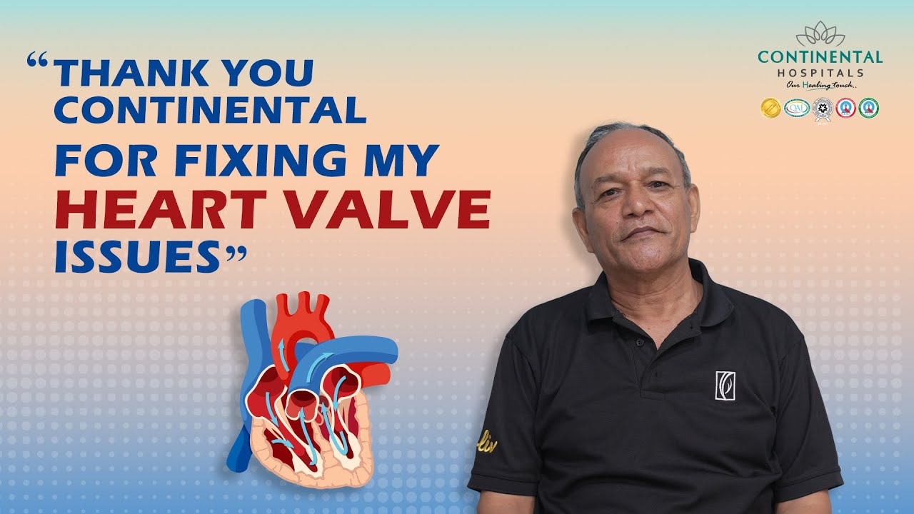 Minimally Invasive Aortic Valve Replacement at Continental Hospitals
