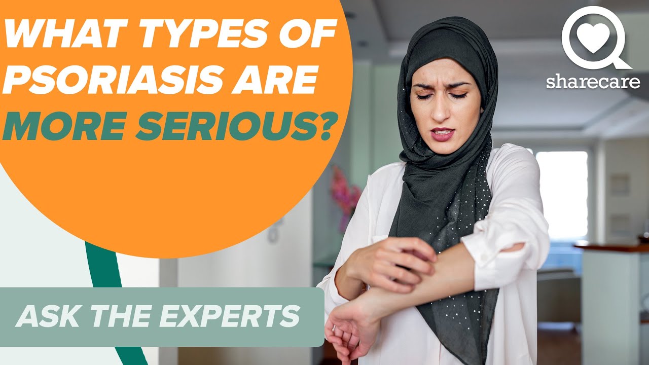 What Types of Psoriasis Are More Serious? | Ask The Experts | Sharecare