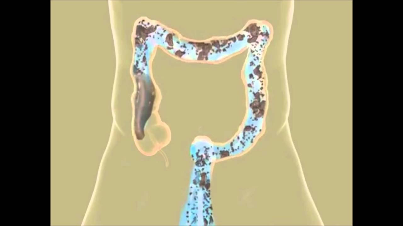 Colon Hydrotherapy in Pune | Constipation Treatment | Piles Treatment | Detox | Colon Cleansing IBS