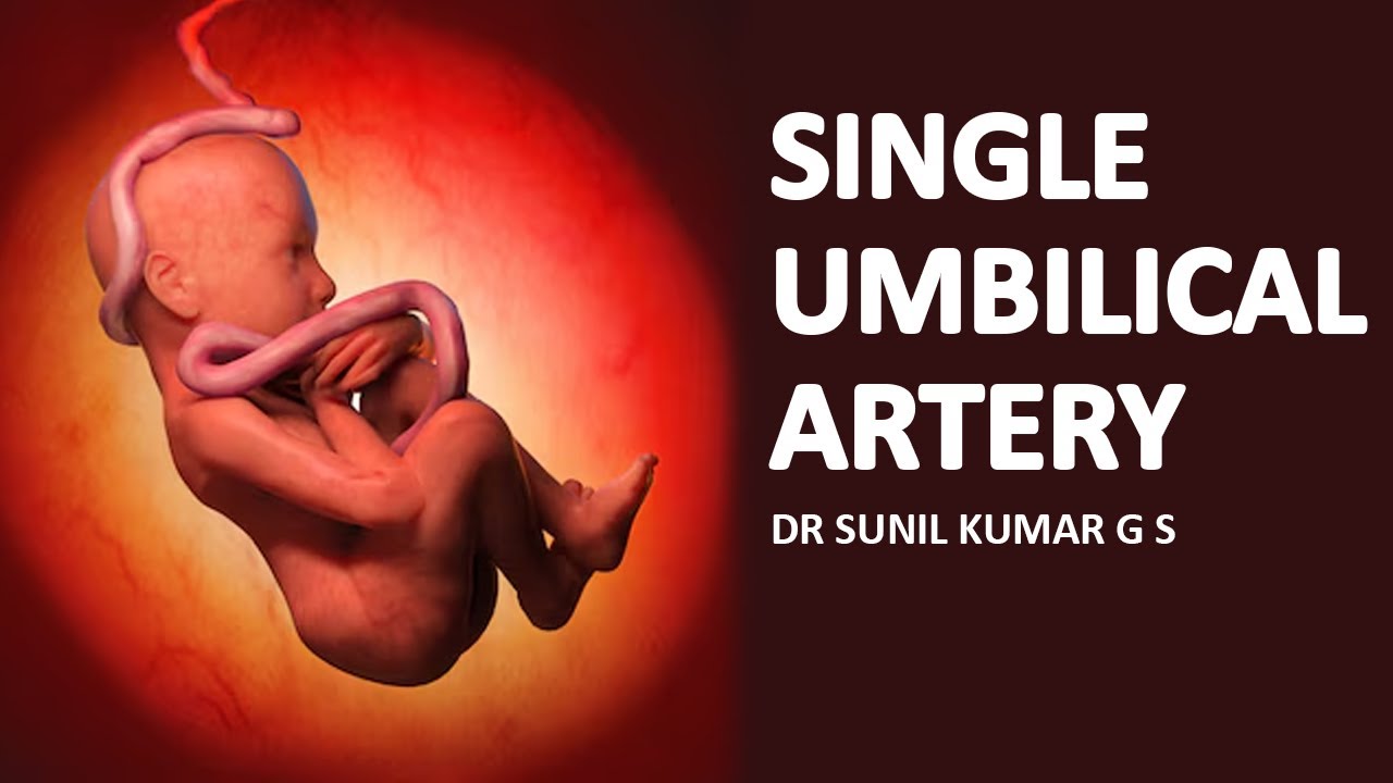 Single Umbilical Artery | Dr. Sunil Kumar G S| #singleumbilicalartery #pregnancytips #pregnancycare