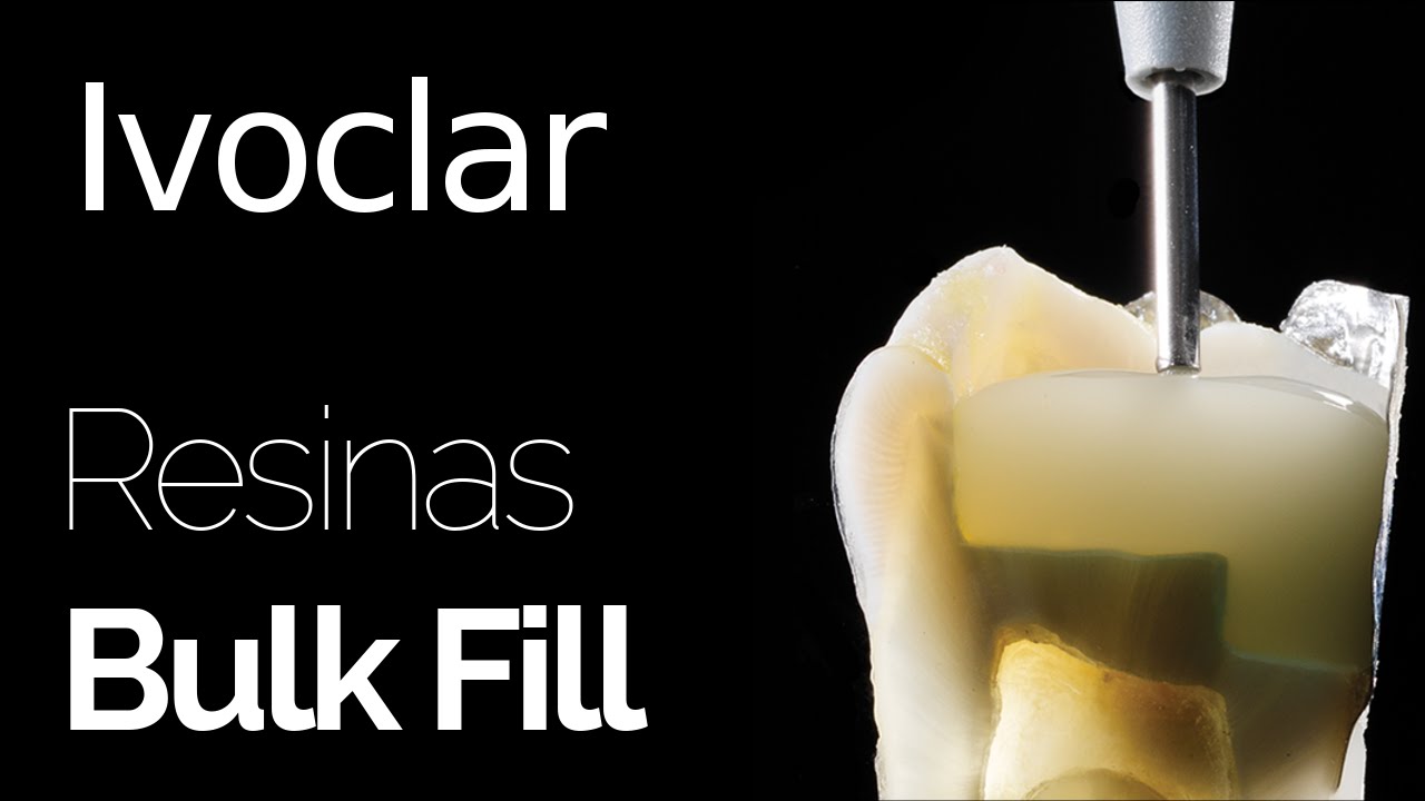 Ivoclar  - Resinas Bulk Fill