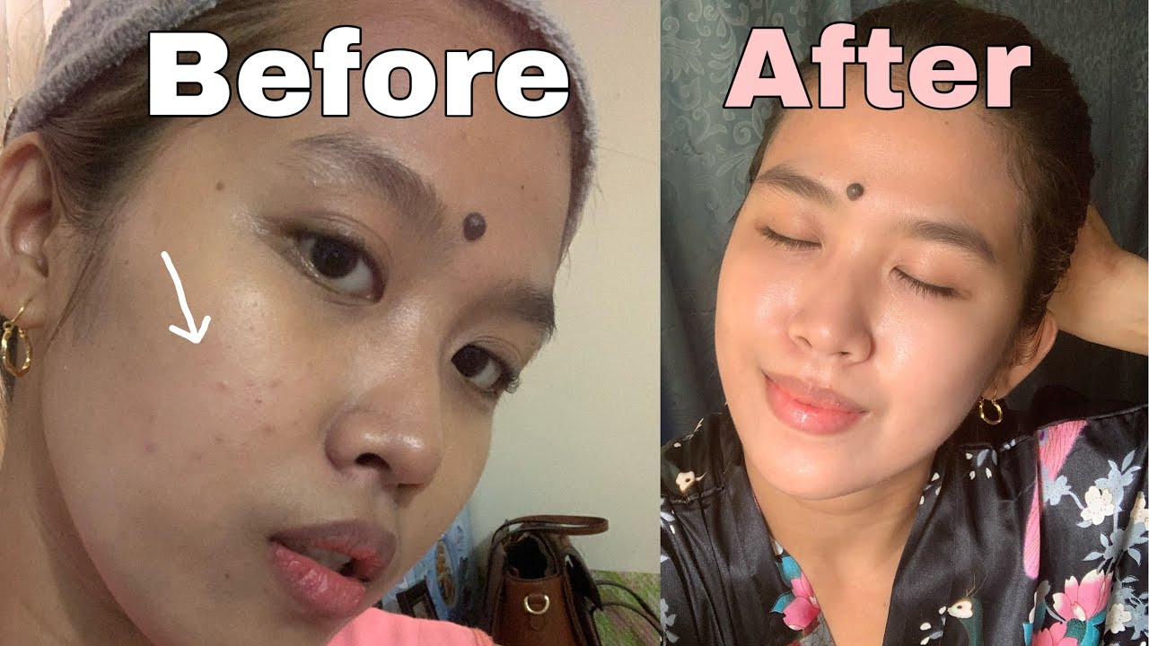 Safe Skincare Products for Breastfeeding Moms - Mommy Kath