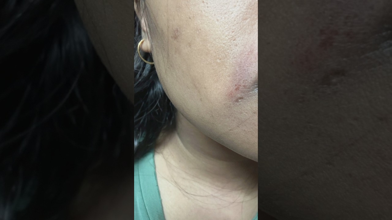 💥 BAD REVIEW: Clorle Aloe Vera Wax Powder
