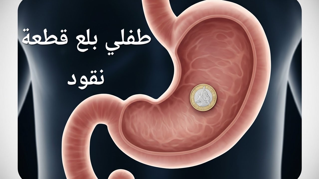طفلي بلع قطعة نقود