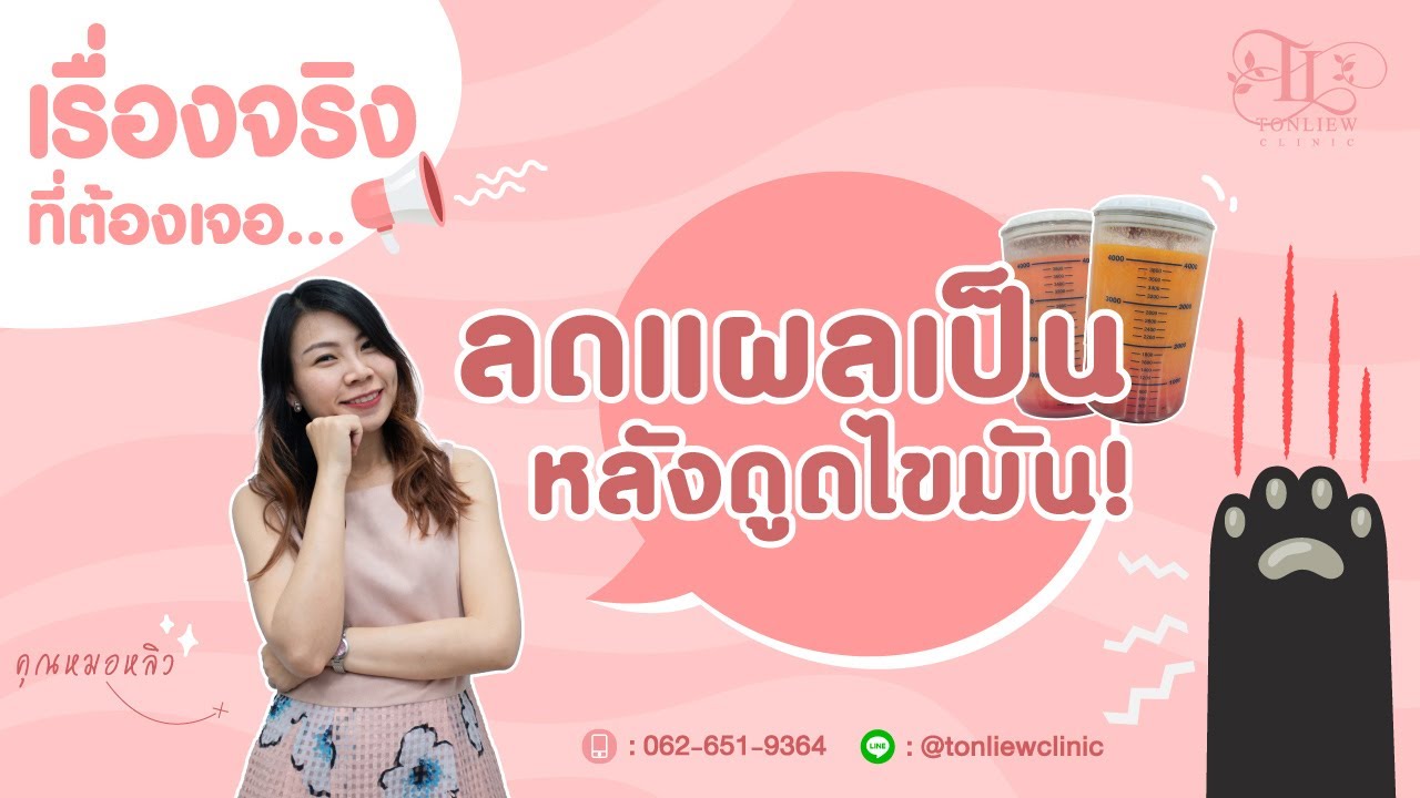 เทคนิคในการลดแผลเป็น แผลคีลอยด์ หลังดูดไขมัน? - หมอหลิว ต้นหลิวคลินิก