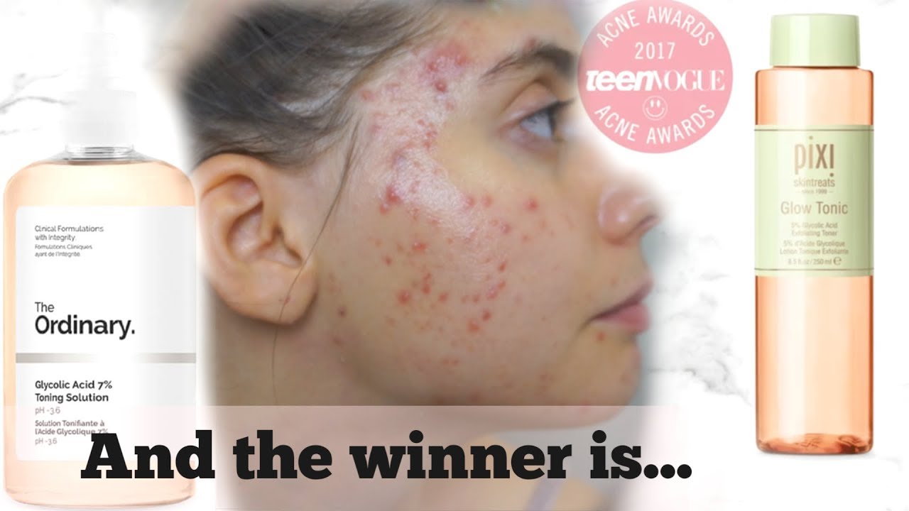 THE PIXI GLOW TONIC vs THE ORDINARY GLYCOLIC ACID 7% SOLUTION TONER || Which one wins...