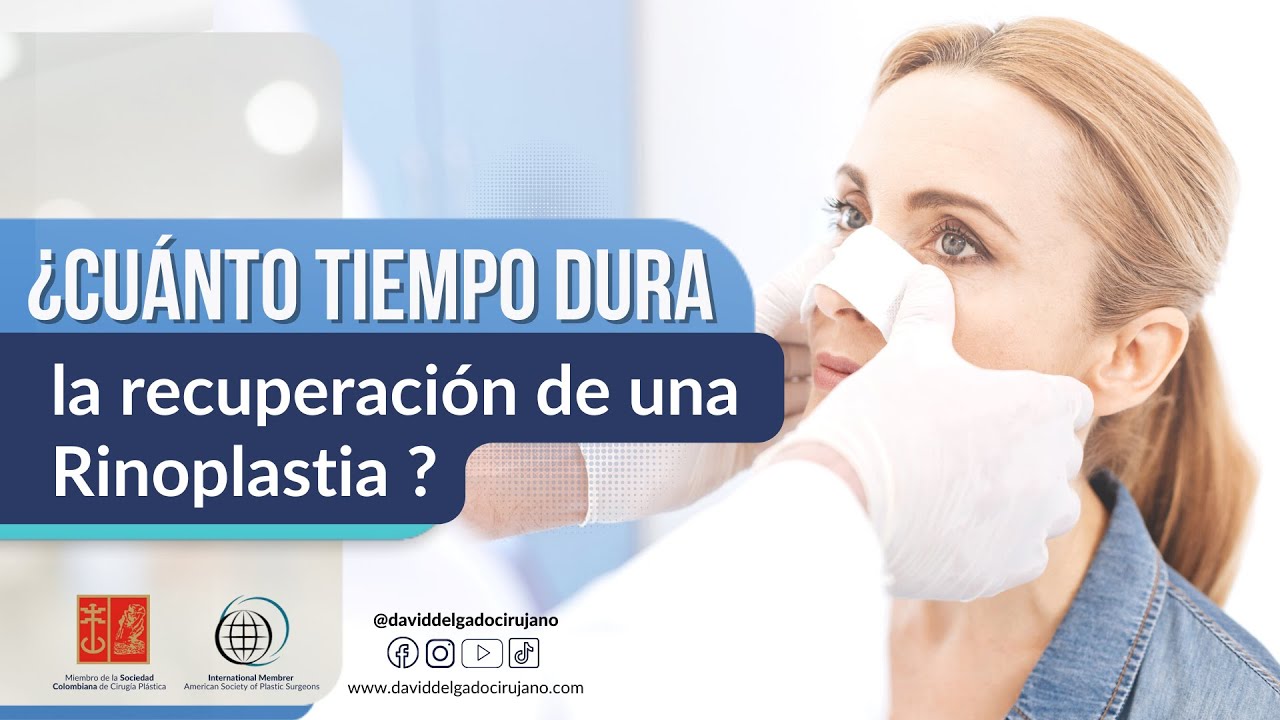 &iquest;Cu&aacute;nto tiempo dura la recuperaci&oacute;n de una Rinoplastia? I Recuperaci&oacute;n de Rinoplastia I Cirug&iacute;a