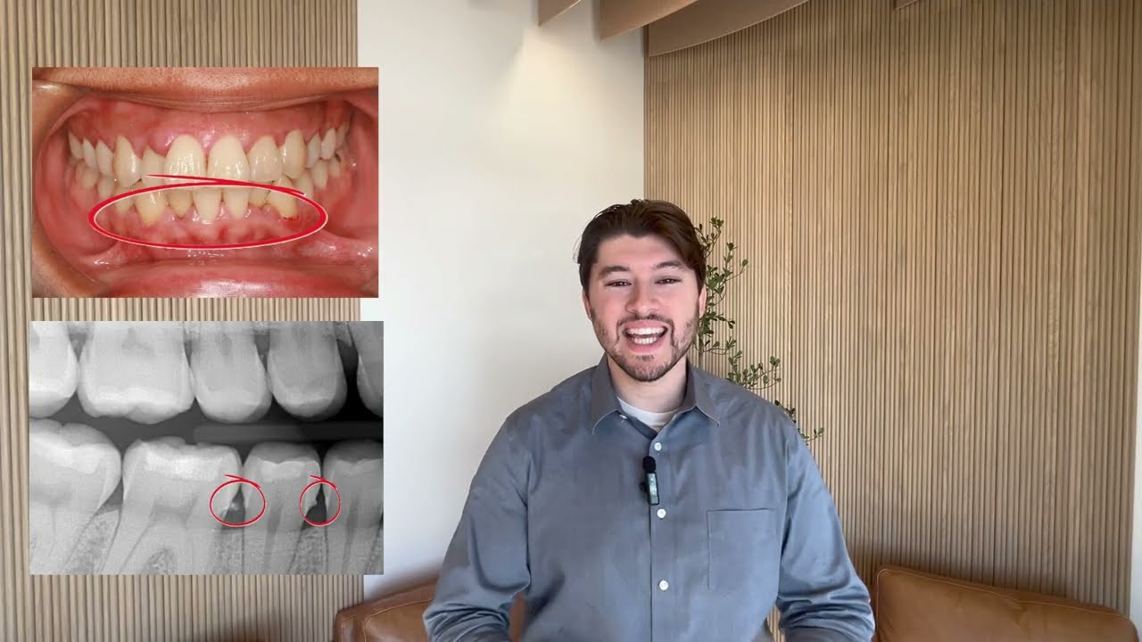 Dental X-Rays 101: What Every Patient Should Know