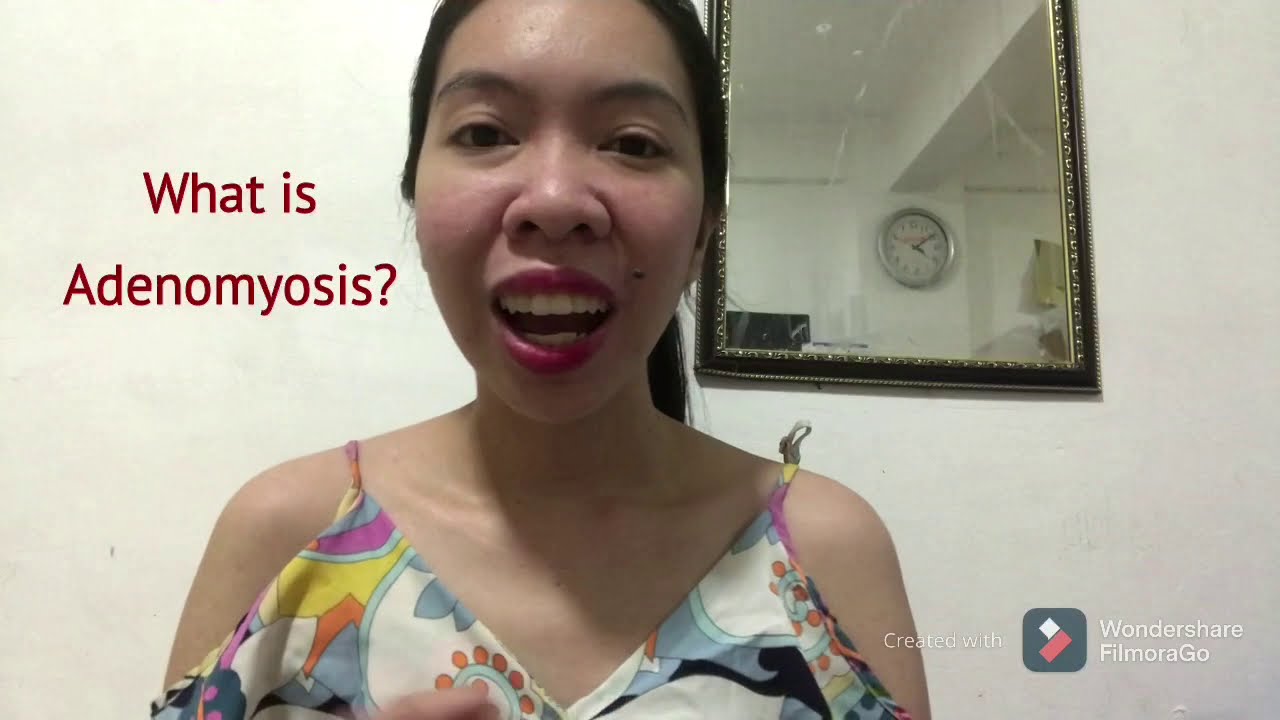 Adenomyosis