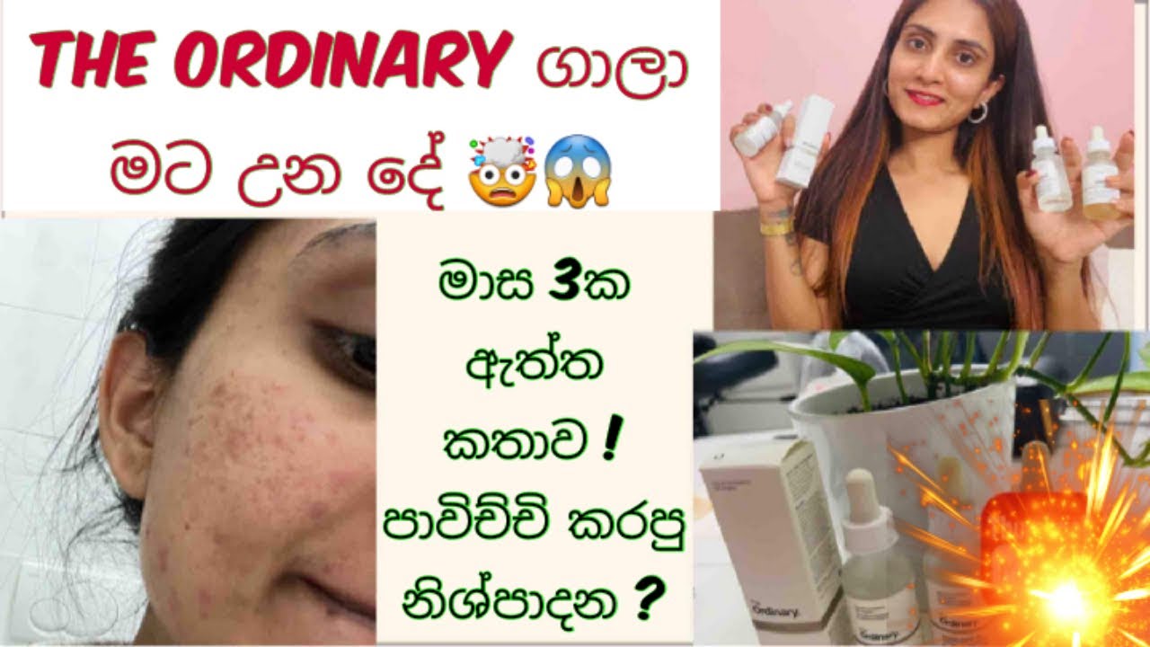 Truth about the ordinary,Sinhala review,I tested 03 Months,The ordinary skin care challenge 🫣😱
