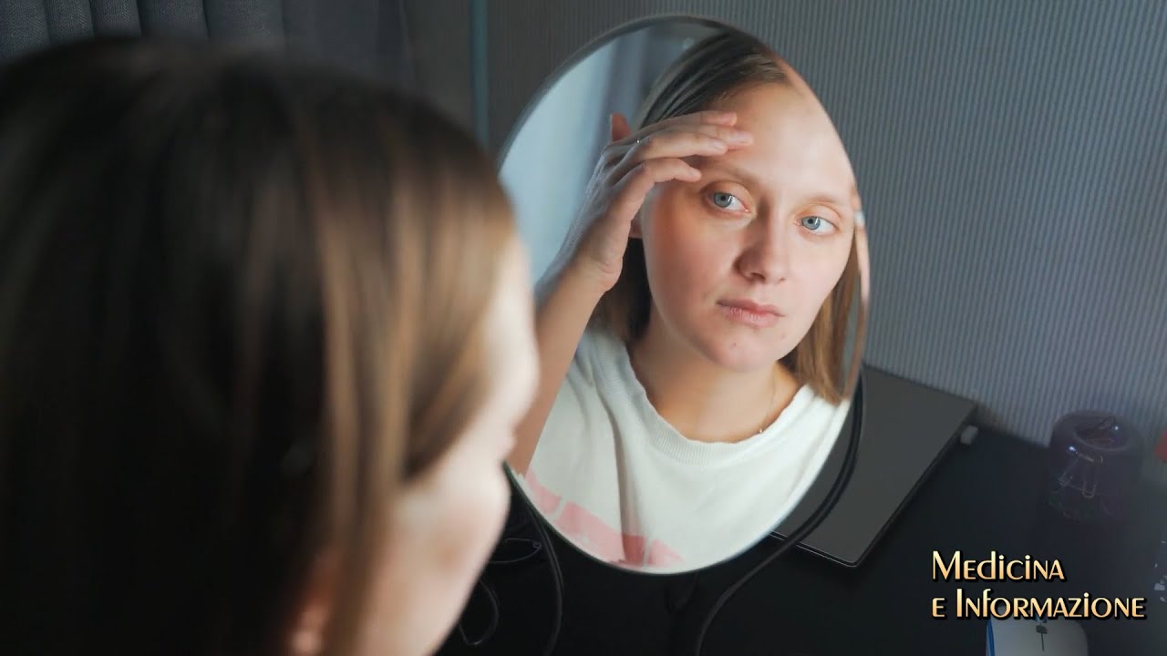 VITILIGINE: LE CAUSE, L'IMPATTO SOCIALE E NOVITA' DI CURA CON TERAPIE TOPICHE DI ULTIMA GENERAZIONE
