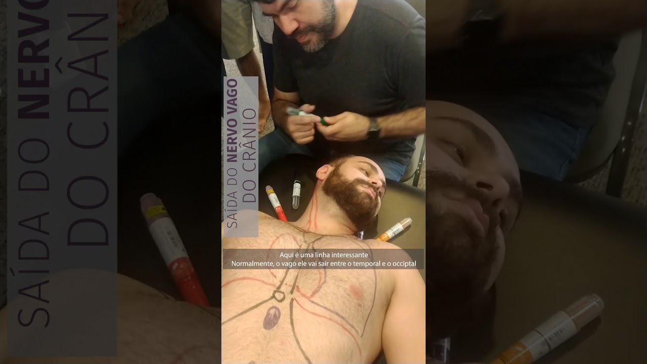 Saída do nervo vago do crânio