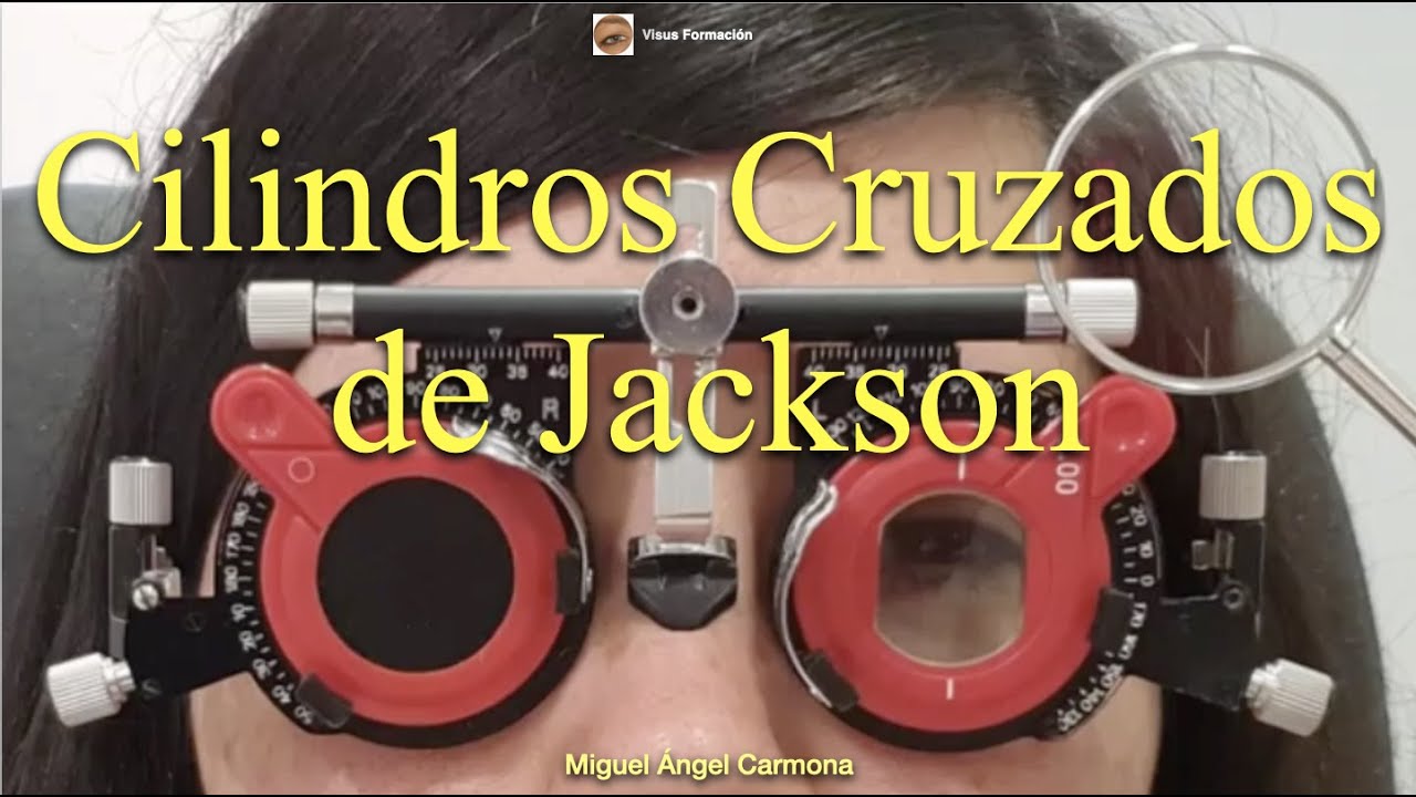 Cilindros Cruzados de Jackson.