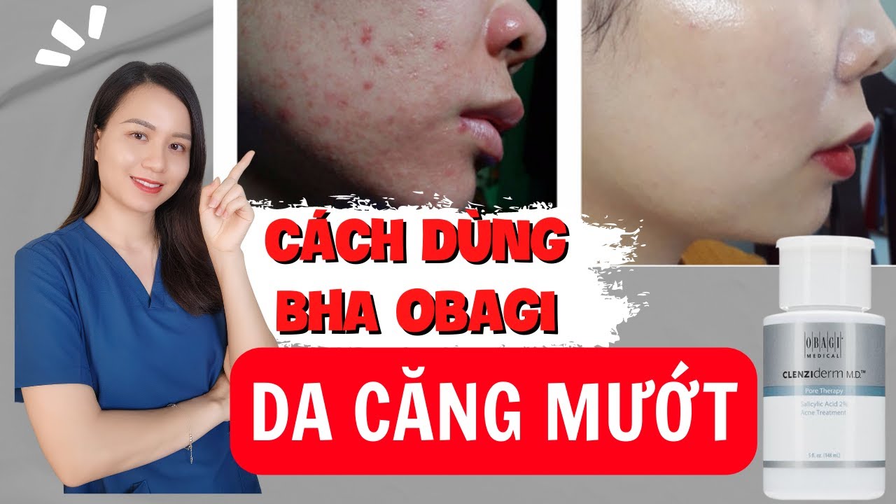 80% các bạn mua mà không biết cách dùng BHA OBAGI nên da không đẹp | Nguyễn Mai Hương