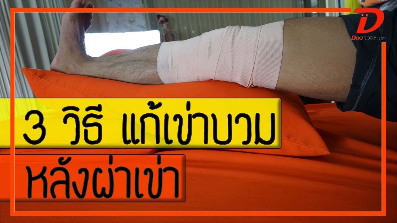 (คลิป 125) 3 วิธีแก้เข่าบวม หลังผ่าเข่าด้วยตนเอง