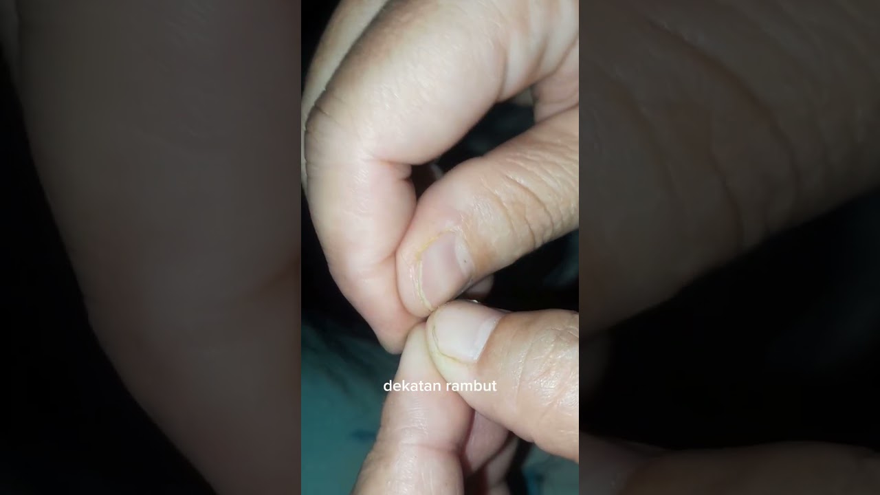 Pengalaman mencari kutu