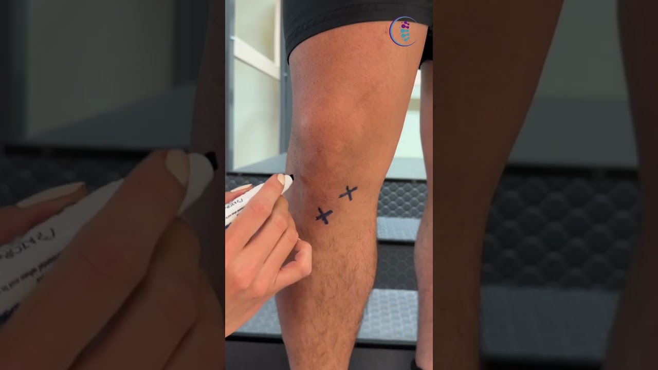 &iquest;Lesi&oacute;n en la rodilla? Identifica cu&aacute;l puede ser tu lesi&oacute;n. #dolor #rodilla