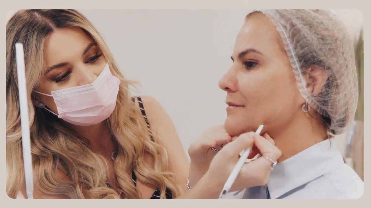 Morpheus 8 x Fotona 4D