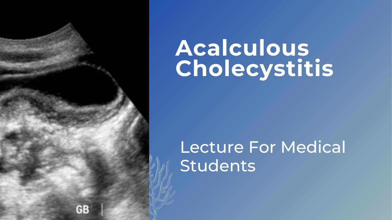 Acalculous cholecystitis  #neetpg #fmge #usmle
