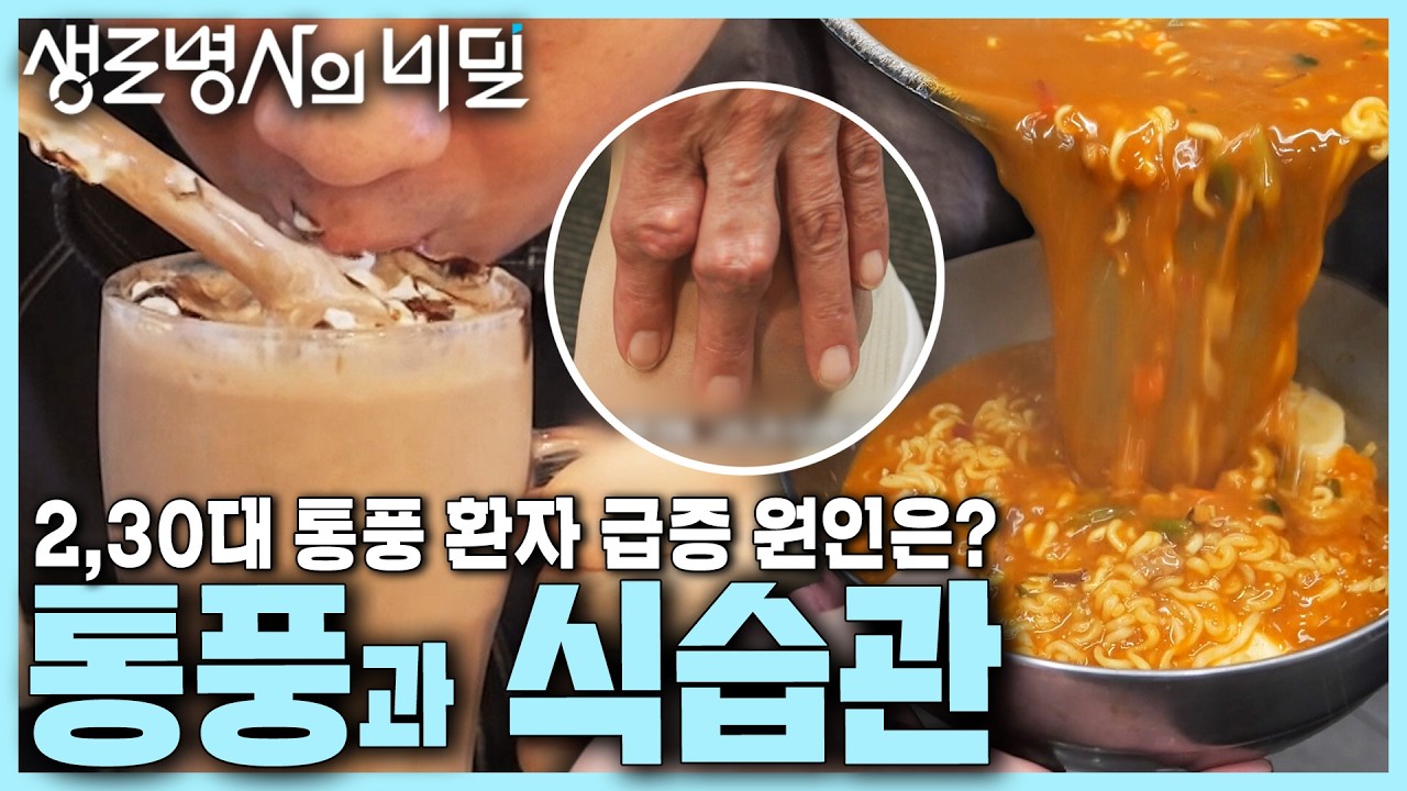 [본방 종합] 통풍을 부르는 식습관🍺 젊은 통풍 환자 급증하는 이유는? 요산 수치 올리는 액상과당 | 젊은 그대, 통풍을 조심하라 | KBS 241106