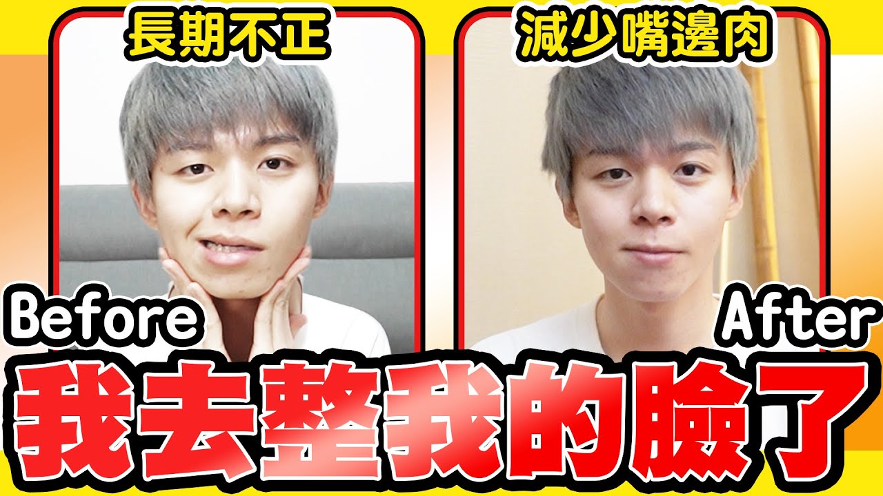 整臉體驗，歪掉的臉骨真的能推回來嗎？【黃氏兄弟】