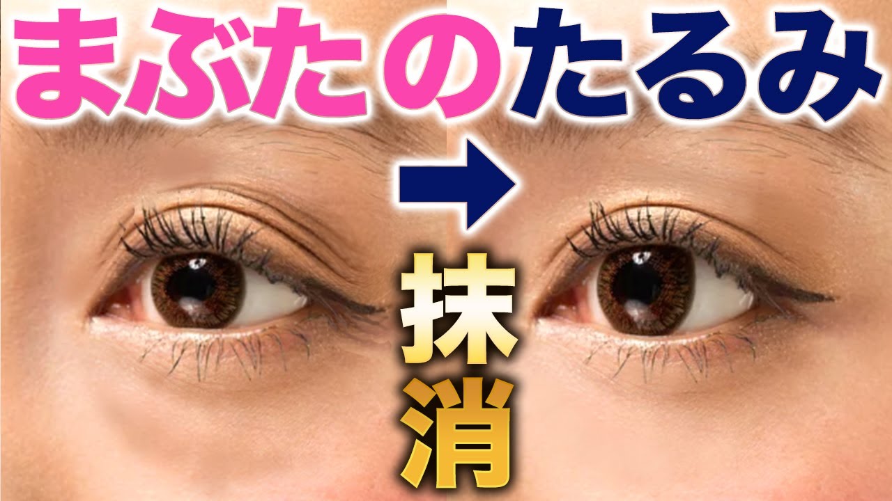 【老け顔】瞼のたるみ本気で消したい方用！1週間で完全に消えます。
