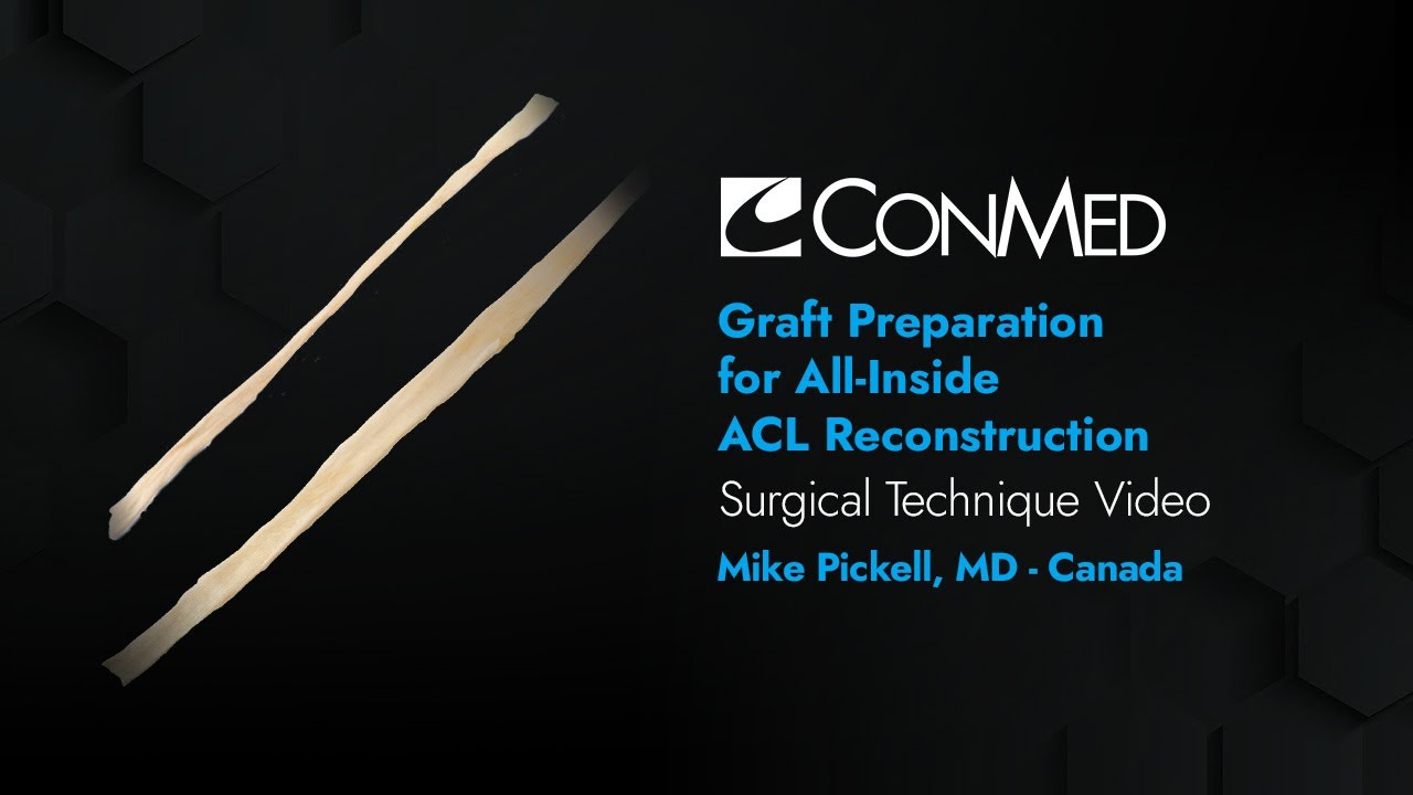 Dr. Mike Pickell - Graft Prep for All Inside ACL Reconstruction - CONMED Surgical Technique