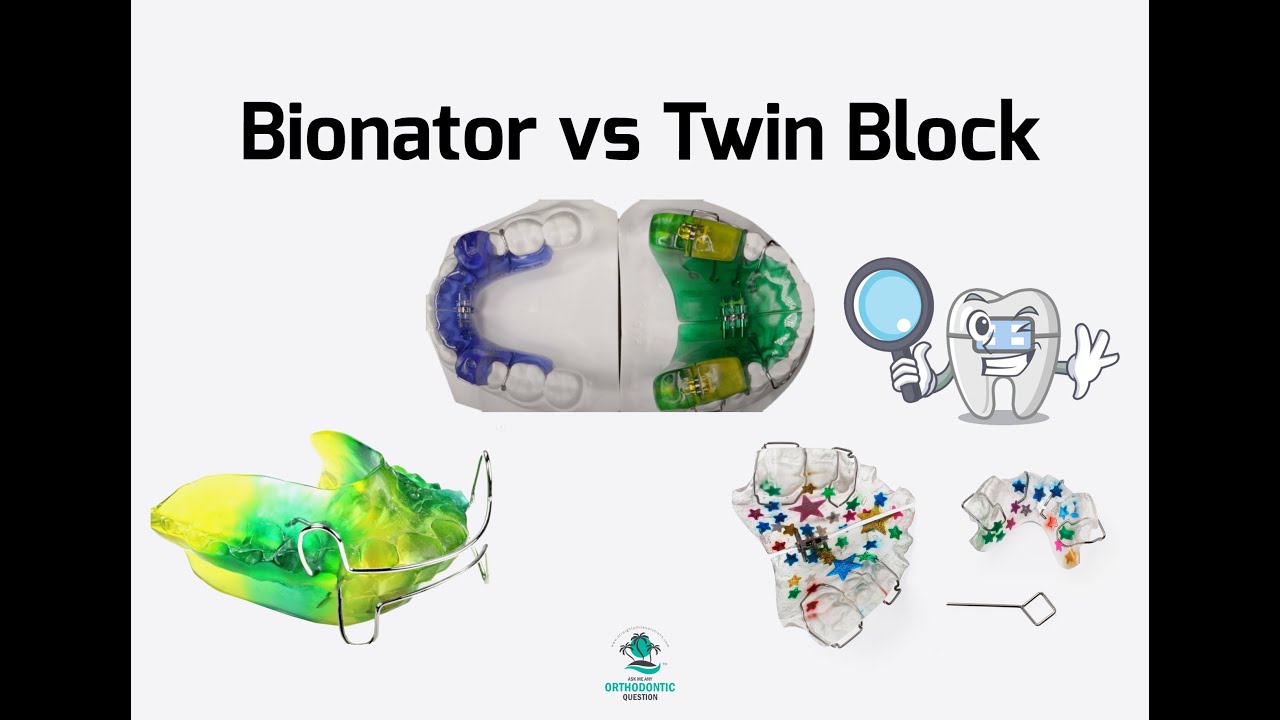 Bionator vs TwinBlock