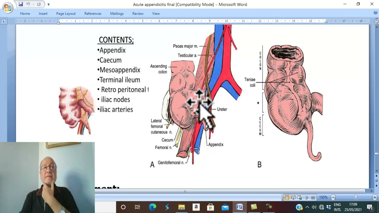 Appendicitis in Arabic 6 ( Appendicitis , part 6 ) , by Dr. Wahdan
