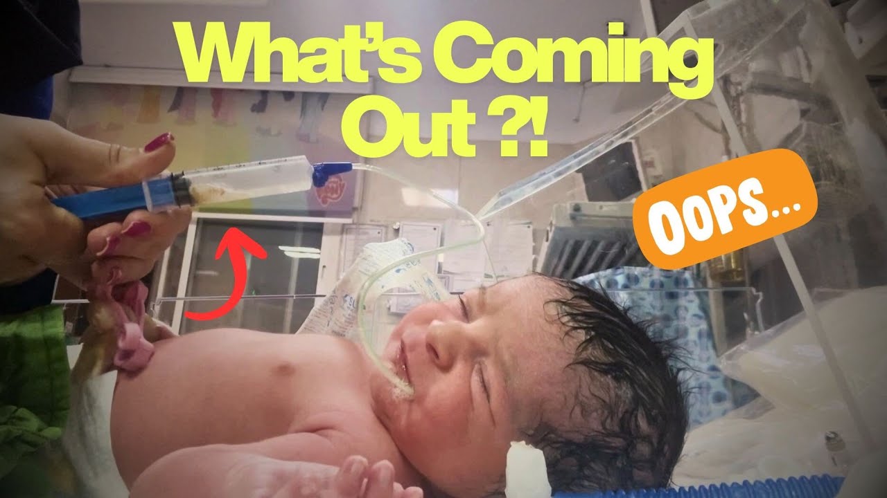 Real NICU Procedure: This Shocked Even the Nurses 😳