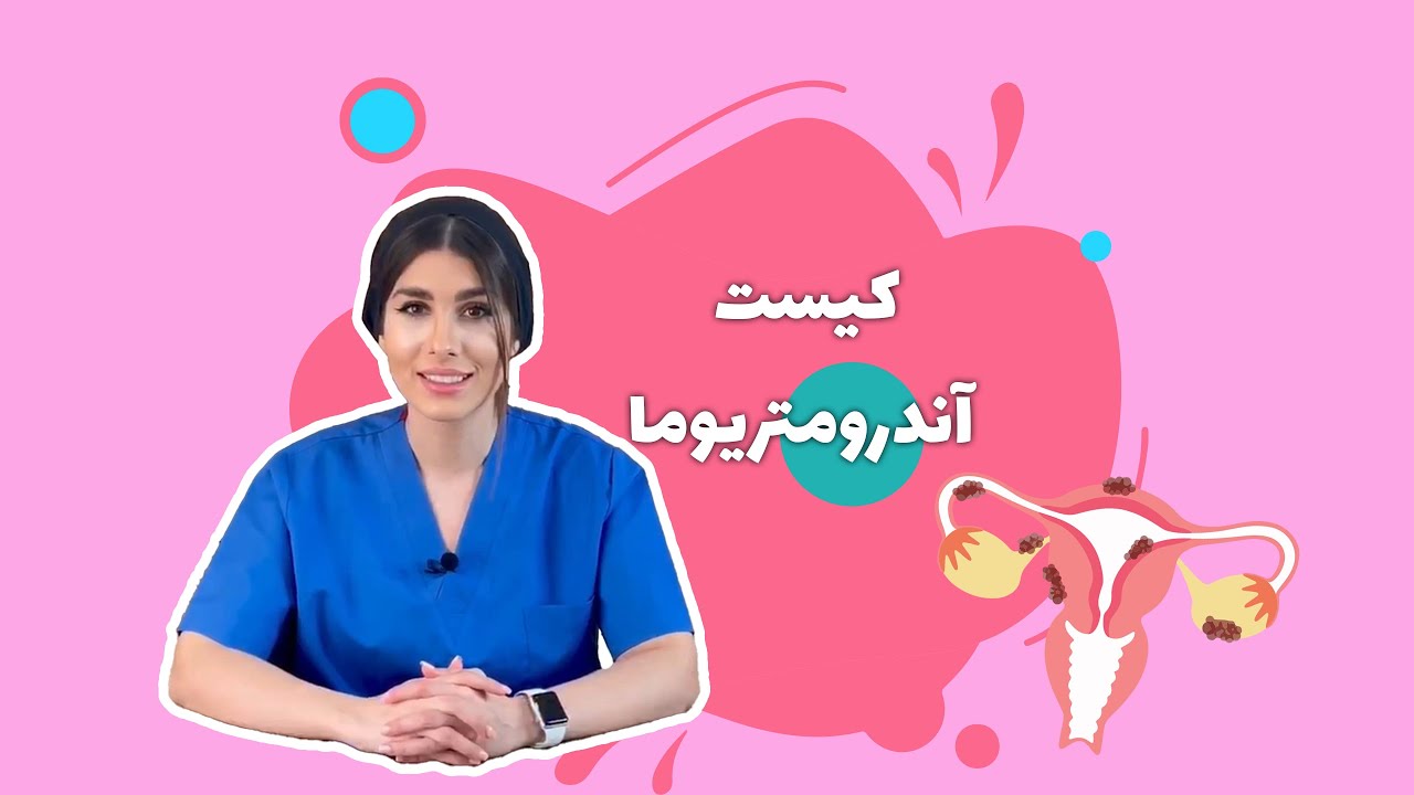 &diams;️کیست اندومتریوما