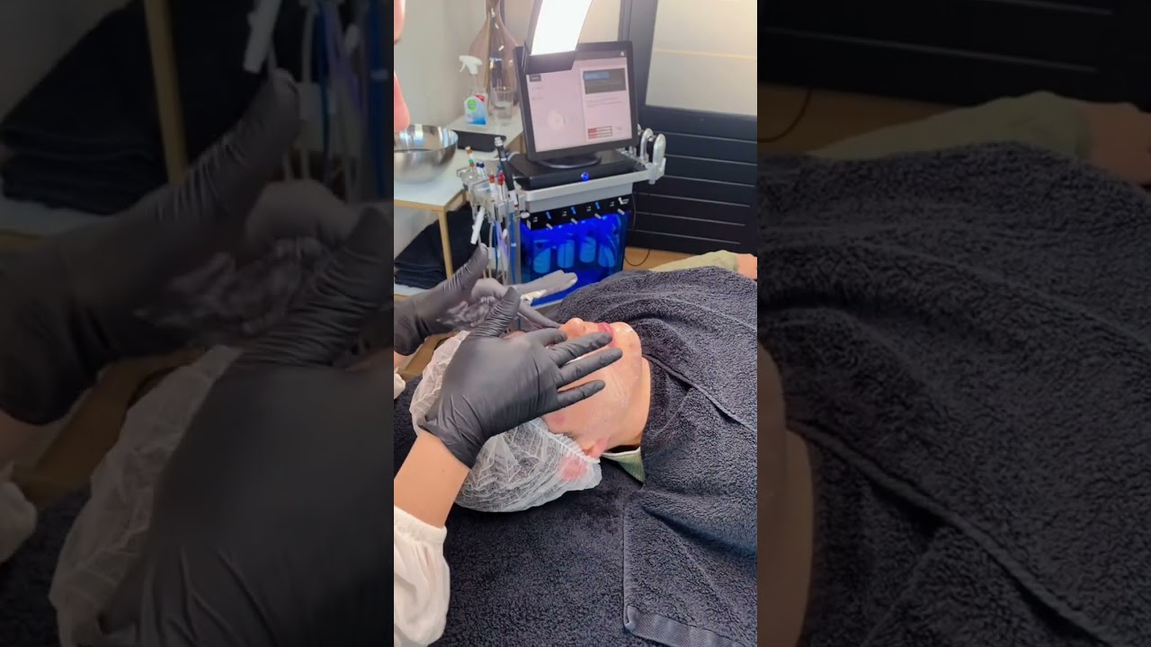 HydraPeel combinatiebehandeling 💧