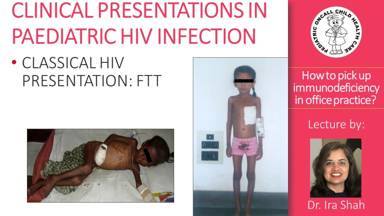 Dr. Ira Shah : How to pick up Immunodeficiency? | Pediatric Oncall