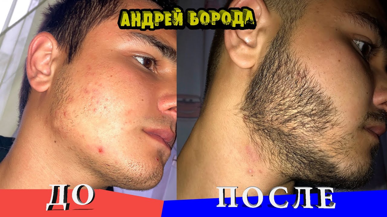 Минокс работает, но не всегда / До и После / Андрей Борода / Выпуск № 15 