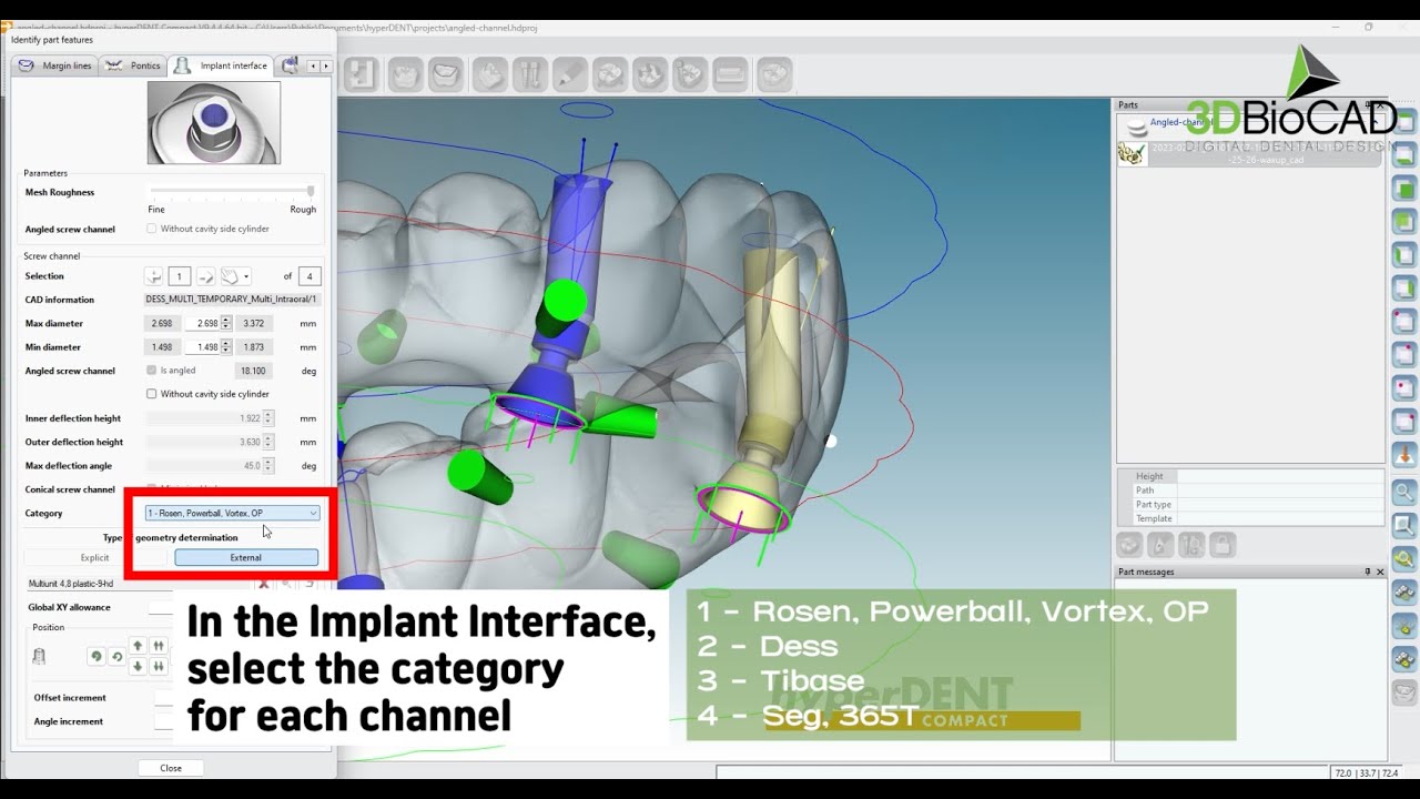 3DBioCAD - HyperDENT Abutment Creator (direct to MUA cases)
