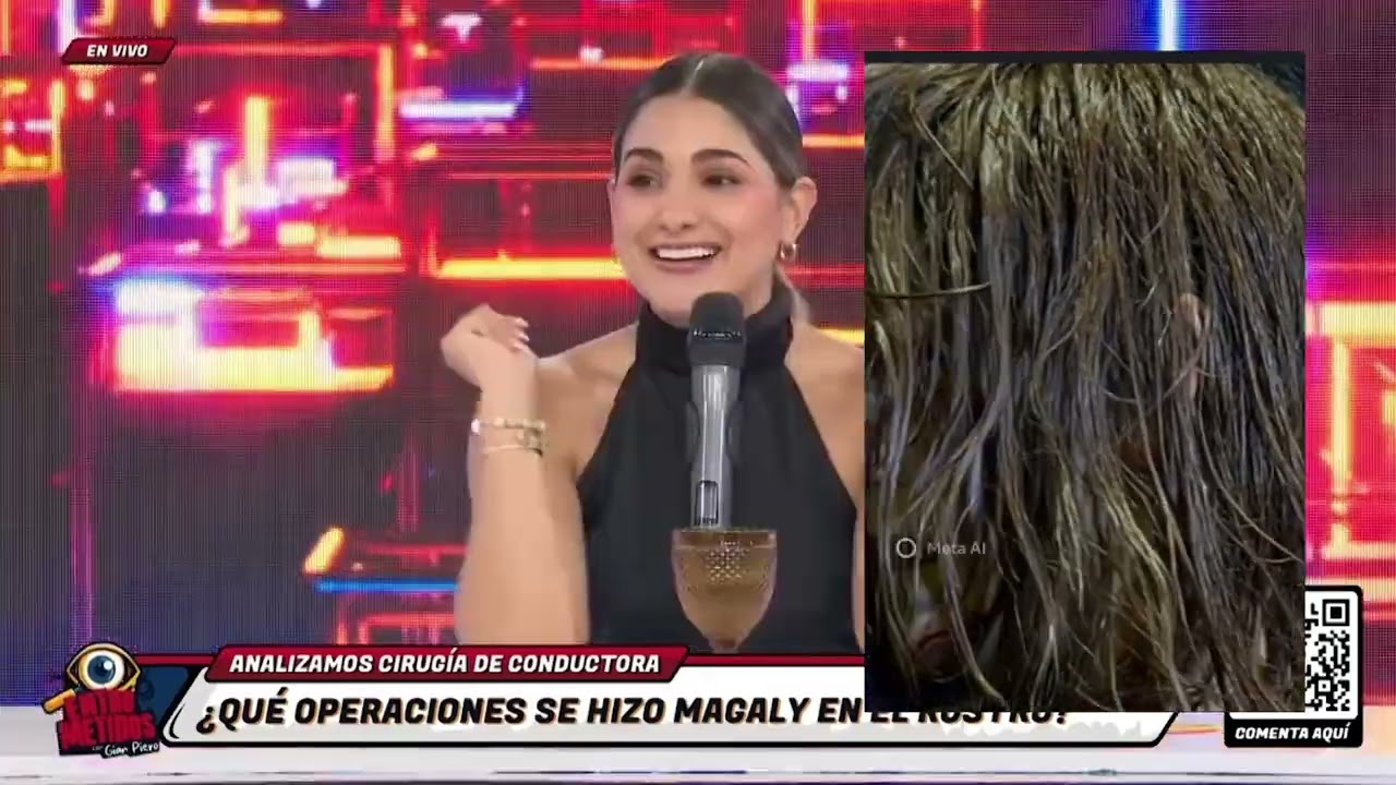 Entrevista por la cirugía Deep Plane que se hizo Magaly Medina. Dra. Diana Reátegui 