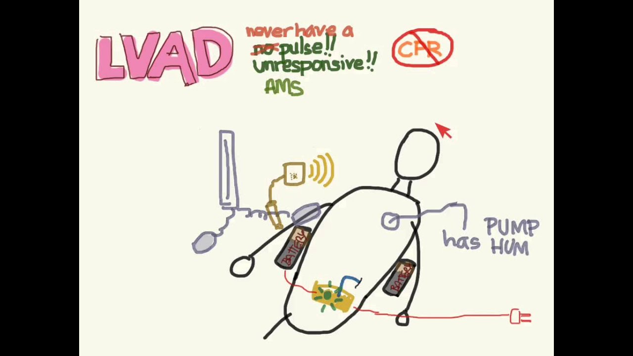 LVAD 02: Pathophysiology