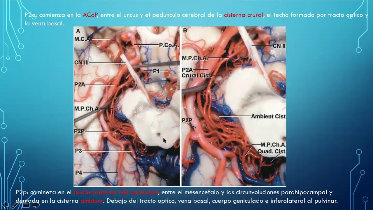 ARTERIA CEREBRAL POSTERIOR (PARTE 1)