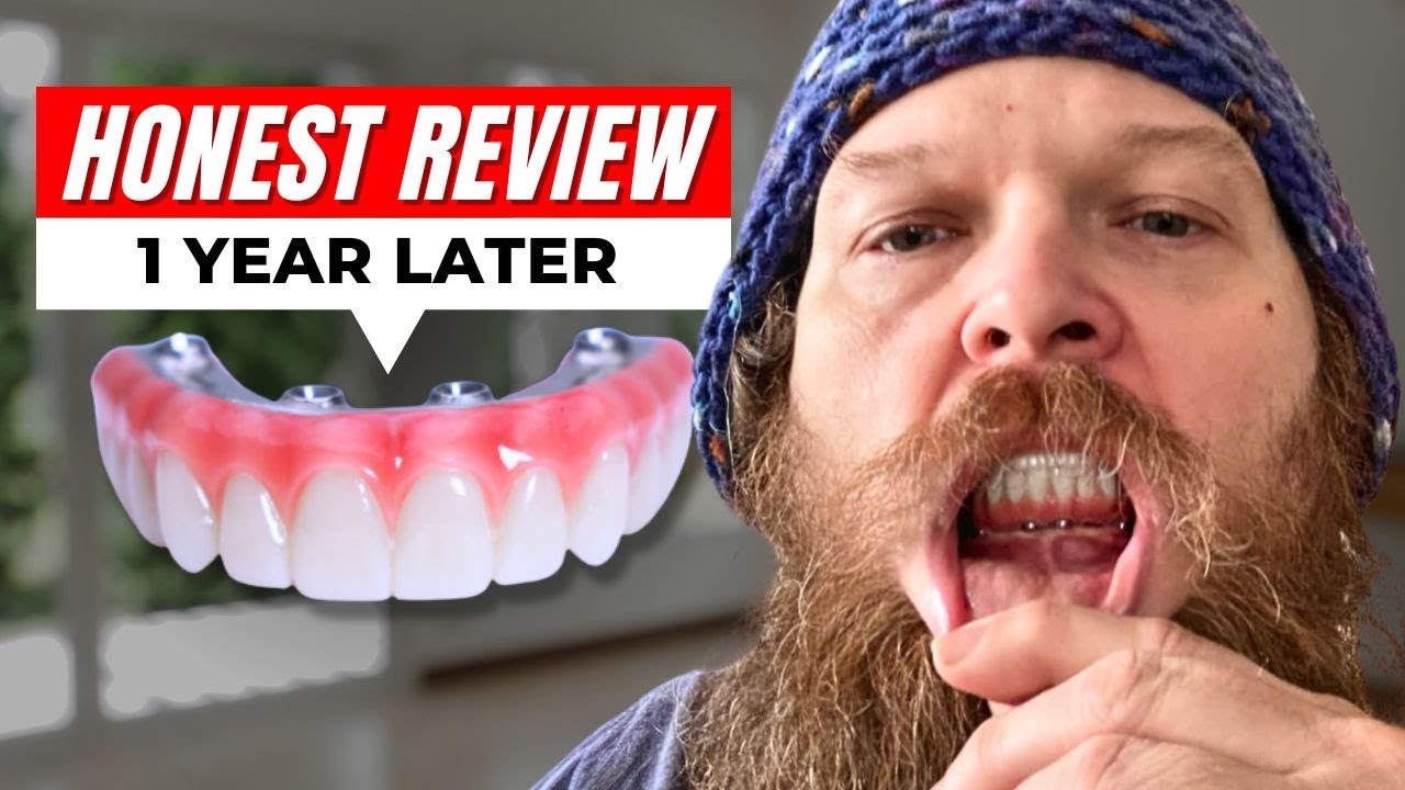 5 Things I Wish I'd Known Before Dental Implants