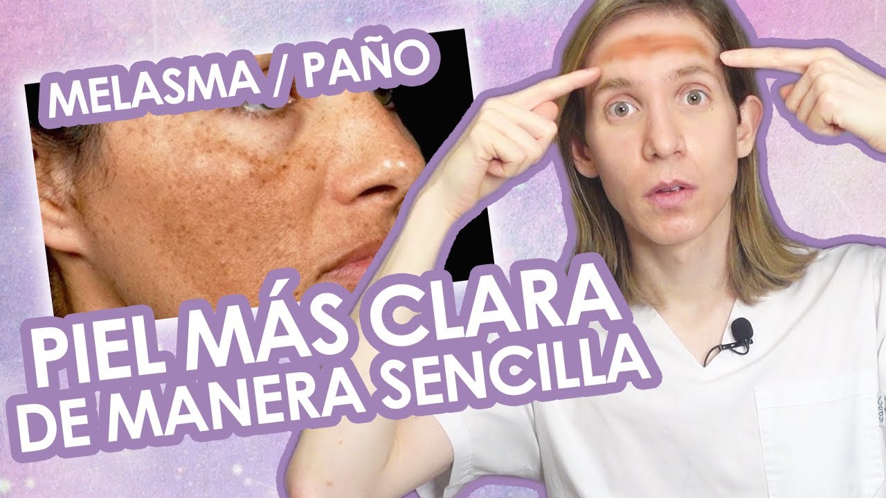 COMO ACLARAR LA PIEL DE LA CARA - Como borrar el Melasma desde casa - Simon Scarano Dermatologo