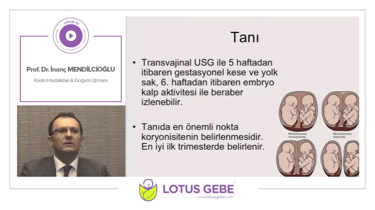 Prof. Dr. İnanç Mendilcioğlu - Çoğul Gebelikler