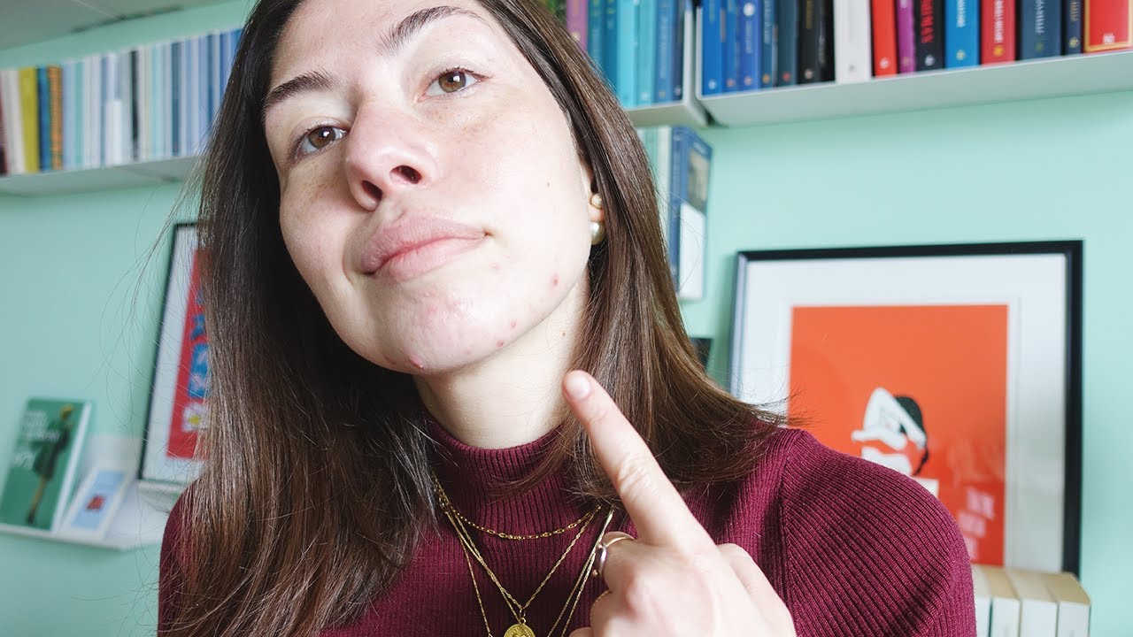 La mia faccia senza trucco | Acne e come accettarsi