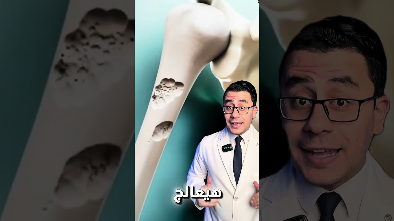 اقوى مشروب لصحة العظام والغضاريف