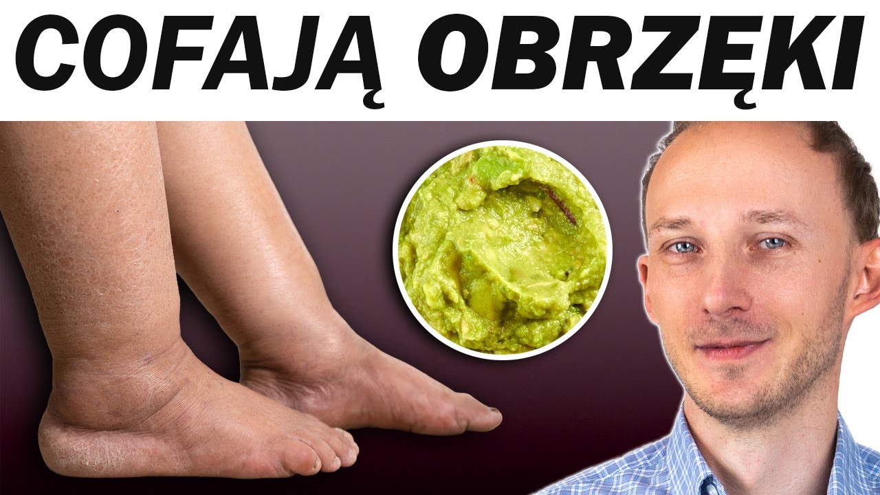 Najzdrowsze produkty na obrzęki stóp i kostek (i dlaczego puchną)