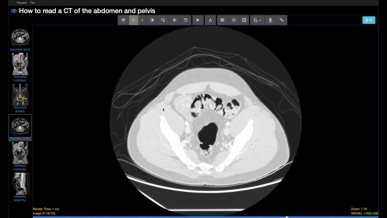 How to use a basic PACS viewer - what every medical student and resident should know