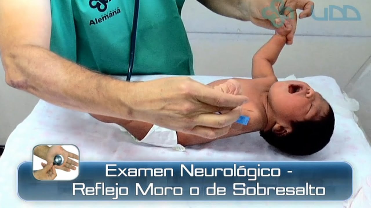 🌟REFLEJO MORO O DE SOBRESALTO DEL RECIÉN NACIDO🌟
