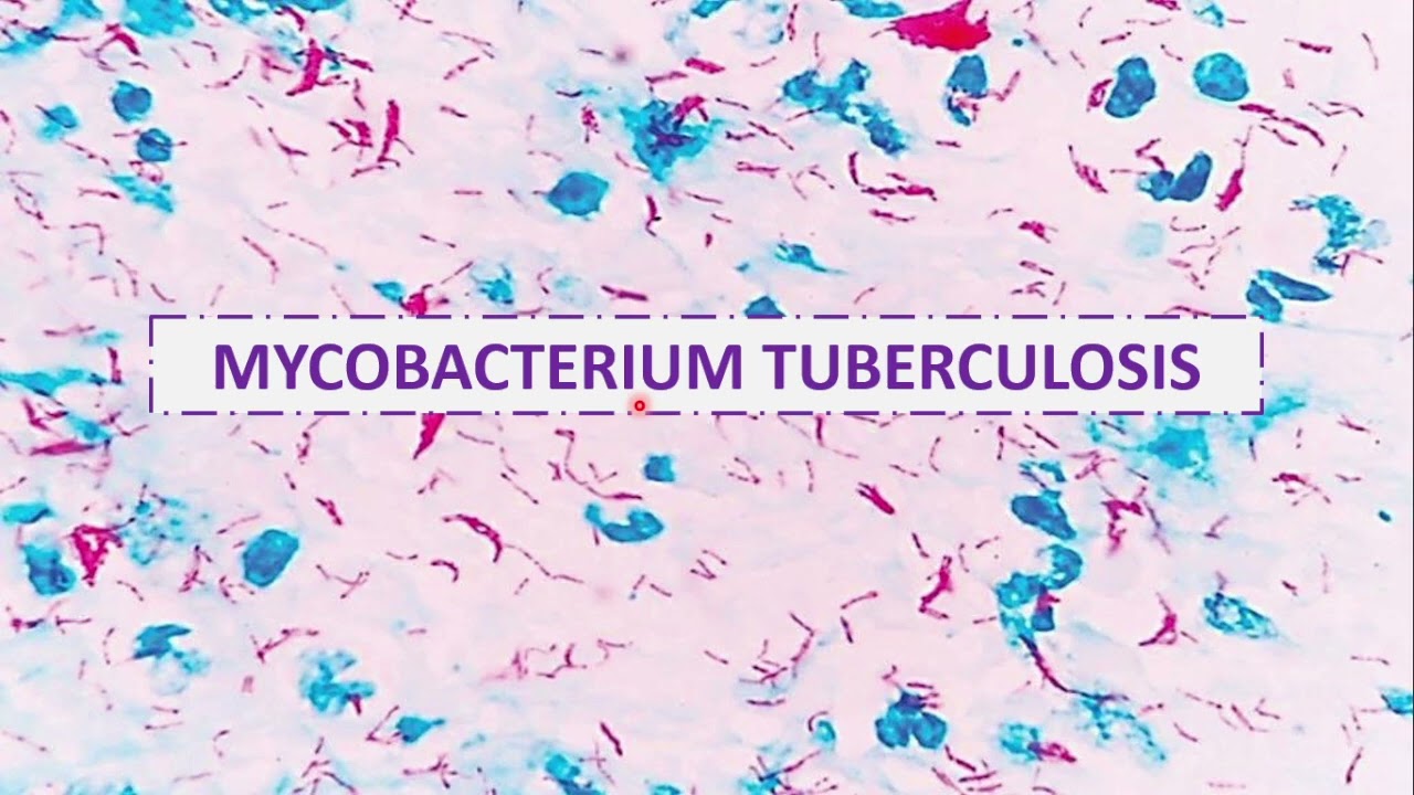 CICLO VERANO 2024 – MICROBIOLOGÍA MÉDICA – SEMANA N°6