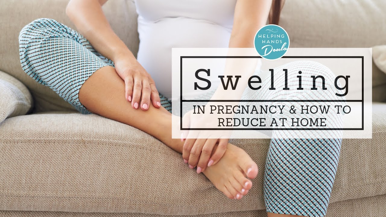 Pregnancy Hacks: How to Reduce Swelling at Home